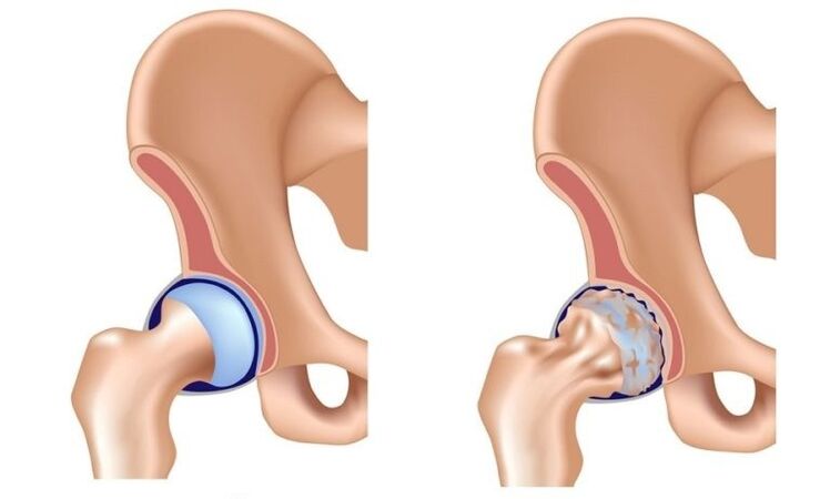 Playful with healthy playful and arthrosis